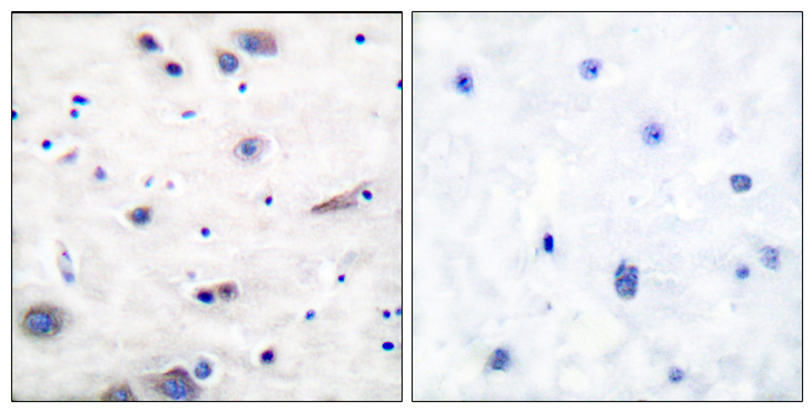 PTPN11 / SHP-2 / NS1 Antibody - Immunohistochemistry analysis of paraffin-embedded human brain, using SHP-2 (Phospho-Tyr580) Antibody. The picture on the right is blocked with the phospho peptide.