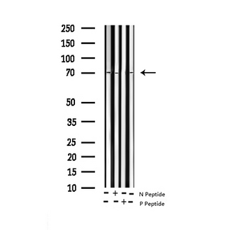 PTPN11 / SHP-2 / NS1 Antibody - Western blot analysis of Phospho-SHP-2 (Tyr580) expression in various lysates