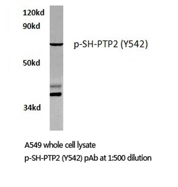 PTPN11 / SHP-2 / NS1 Antibody - Western blot of p-SH-PTP2 (Y580) pAb in A549 cells.