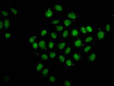 PTPN14 / PEZ Antibody - Immunofluorescence staining of Hela cells diluted at 1:133, counter-stained with DAPI. The cells were fixed in 4% formaldehyde, permeabilized using 0.2% Triton X-100 and blocked in 10% normal Goat Serum. The cells were then incubated with the antibody overnight at 4°C.The Secondary antibody was Alexa Fluor 488-congugated AffiniPure Goat Anti-Rabbit IgG (H+L).