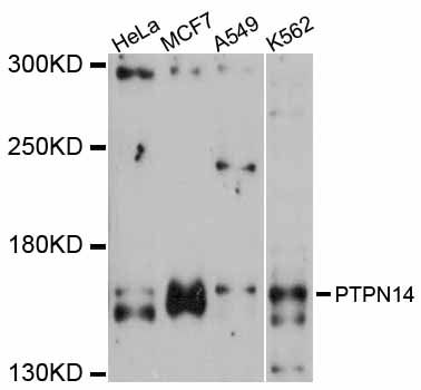 PTPN14 / PEZ Antibody - Western blot analysis of extracts of various cell lines, using PTPN14 antibody at 1:3000 dilution. The secondary antibody used was an HRP Goat Anti-Rabbit IgG (H+L) at 1:10000 dilution. Lysates were loaded 25ug per lane and 3% nonfat dry milk in TBST was used for blocking. An ECL Kit was used for detection and the exposure time was 90s.