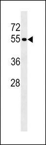 PTPN18 Antibody - PTPN18 Antibody western blot of MDA-MB231 cell line lysates (35 ug/lane). The PTPN18 antibody detected the PTPN18 protein (arrow).