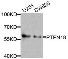 PTPN18 Antibody - Western blot analysis of extracts of various cells.