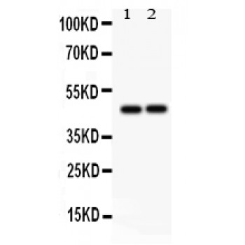 PTPN2 / TC-PTP Antibody - TCPTP antibody Western blot. All lanes: Anti TCPTP at 0.5 ug/ml. Lane 1: HELA Whole Cell Lysate at 40 ug. Lane 2: JURKAT Whole Cell Lysate at 40 ug. Predicted band size: 48 kD. Observed band size: 48 kD.