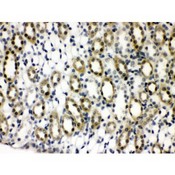 PTPN2 / TC-PTP Antibody - TCPTP antibody IHC-paraffin. IHC(P): Rat Kidney Tissue.