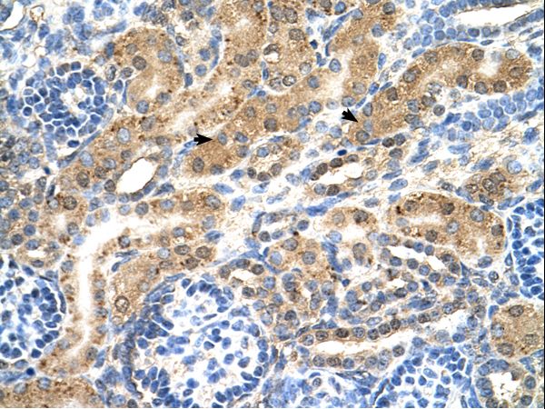 PTPN2 / TC-PTP Antibody - PTPN2 / TCPTP antibody PTPN2(protein tyrosine phosphatase, non-receptor type 2) Antibody was used in IHC to stain formalin-fixed, paraffin-embedded human kidney.  This image was taken for the unconjugated form of this product. Other forms have not been tested.