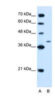 PTPN2 / TC-PTP Antibody - PTPN2 / TCPTP antibody ARP45362_T100-NP_536348-PTPN2(protein tyrosine phosphatase, non-receptor type 2) Antibody Western blot of Jurkat lysate.  This image was taken for the unconjugated form of this product. Other forms have not been tested.