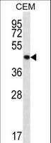 PTPN2 / TC-PTP Antibody - PTPN2 Antibody western blot of CEM cell line lysates (35 ug/lane). The PTPN2 antibody detected the PTPN2 protein (arrow).