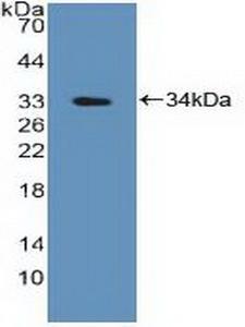 PTPN2 / TC-PTP Antibody - Western Blot; Sample: Recombinant PTPN2, Human.