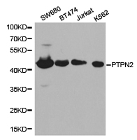 PTPN2 / TC-PTP Antibody - Western blot of extracts of various cell lines, using PTPN2 antibody.