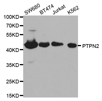 PTPN2 / TC-PTP Antibody - Western blot analysis of extracts of various cell lines, using PTPN2 antibody.