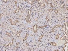 PTPN2 / TC-PTP Antibody - Immunohistochemistry of paraffin-embedded mouse lung using PTPN2 antibody at dilution of 1:100 (200x lens).