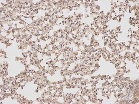 PTPN2 / TC-PTP Antibody - Immunohistochemistry of paraffin-embedded rat kidney using PTPN2 antibody at dilution of 1:100 (200x lens).
