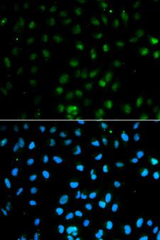 PTPN2 / TC-PTP Antibody - Immunofluorescence analysis of MCF7 cell using PTPN2 antibody. Blue: DAPI for nuclear staining.