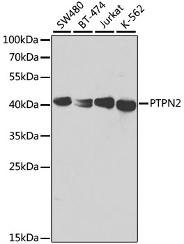 PTPN2 / TC-PTP Antibody - Western blot analysis of extracts of various cell lines, using PTPN2 antibody at 1:1000 dilution. The secondary antibody used was an HRP Goat Anti-Rabbit IgG (H+L) at 1:10000 dilution. Lysates were loaded 25ug per lane and 3% nonfat dry milk in TBST was used for blocking. An ECL Kit was used for detection.