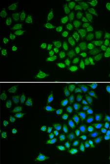 PTPN2 / TC-PTP Antibody - Immunofluorescence analysis of MCF-7 cells using PTPN2 antibody. Blue: DAPI for nuclear staining.