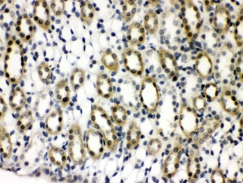 PTPN2 / TC-PTP Antibody