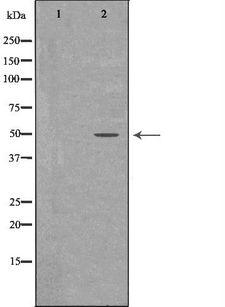 PTPN2 / TC-PTP Antibody - Western blot analysis of K562 whole cells lysates using PTPN2 antibody. The lane on the left is treated with the antigen-specific peptide.