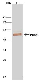PTPN2 / TC-PTP Antibody - PTPN2 was immunoprecipitated using: Lane A: 0.5 mg MOLT-4 Whole Cell Lysate. 1 uL anti-PTPN2 rabbit polyclonal antibody and 15 ul of 50% Protein G agarose. Primary antibody: Anti-PTPN2 rabbit polyclonal antibody, at 1:500 dilution. Secondary antibody: Clean-Blot IP Detection Reagent (HRP) at 1:500 dilution. Developed using the DAB staining technique. Performed under reducing conditions. Predicted band size: 48 kDa. Observed band size: 48 kDa.