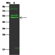 PTPN2 / TC-PTP Antibody - Anti-PTPN2 rabbit polyclonal antibody at 1:500 dilution. Lane A: MOLT4 Whole Cell Lysate. Lysates/proteins at 30 ug per lane. Secondary: Goat Anti-Rabbit IgG H&L (Dylight 800) at 1/10000 dilution. Developed using the Odyssey technique. Performed under reducing conditions. Predicted band size: 48 kDa. Observed band size: 51 kDa. (We are unsure as to the identity of these extra bands.)