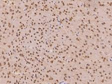PTPN2 / TC-PTP Antibody - Immunochemical staining of mouse PTPN2 in mouse brain with rabbit polyclonal antibody at 1:200 dilution, formalin-fixed paraffin embedded sections.