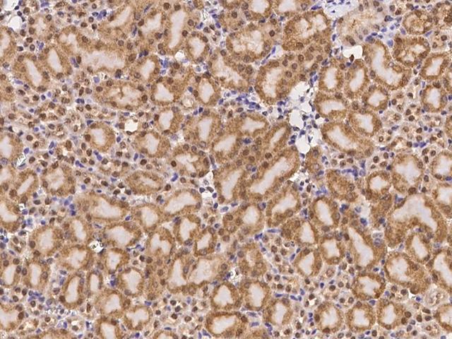 PTPN2 / TC-PTP Antibody - Immunochemical staining of mouse PTPN2 in mouse kidney with rabbit polyclonal antibody at 1:200 dilution, formalin-fixed paraffin embedded sections.