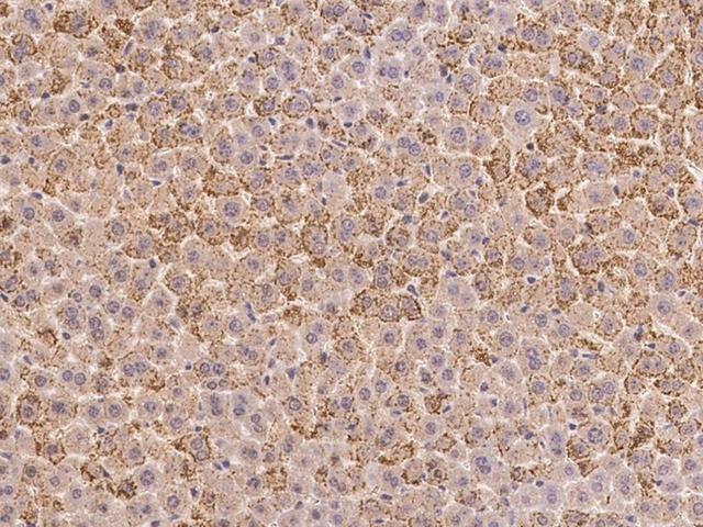 PTPN2 / TC-PTP Antibody - Immunochemical staining of mouse PTPN2 in mouse liver with rabbit polyclonal antibody at 1:200 dilution, formalin-fixed paraffin embedded sections.