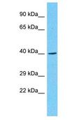PTPN20 Antibody - PTPN20B antibody Western Blot of THP-1. Antibody dilution: 1 ug/ml.  This image was taken for the unconjugated form of this product. Other forms have not been tested.