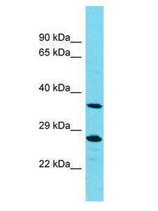 PTPN20 Antibody - PTPN20A antibody Western Blot of MCF7. Antibody dilution: 1 ug/ml.  This image was taken for the unconjugated form of this product. Other forms have not been tested.