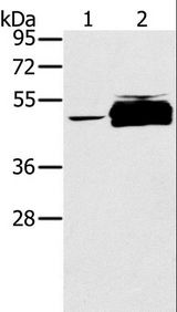 PTPN20 Antibody - Western blot analysis of K562 cell and human testis tissue, using PTPN20B Polyclonal Antibody at dilution of 1:200.