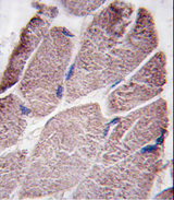 PTPN21 / PTPD1 Antibody - Formalin-fixed and paraffin-embedded human skeletal muscle tissue reacted with PTPD1 antibody , which was peroxidase-conjugated to the secondary antibody, followed by DAB staining. This data demonstrates the use of this antibody for immunohistochemistry; clinical relevance has not been evaluated.