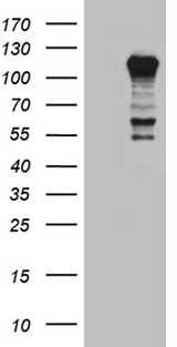 PTPN22 / PEP Antibody - HEK293T cells were transfected with the pCMV6-ENTRY control. (Left lane) or pCMV6-ENTRY PTPN22. (Right lane) cDNA for 48 hrs and lysed