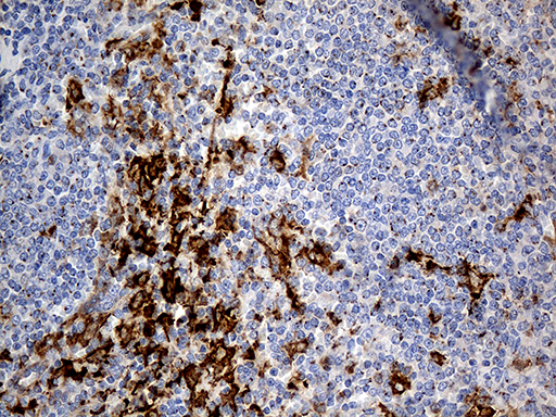PTPN22 / PEP Antibody - Immunohistochemical staining of paraffin-embedded Human lymph node tissue within the normal limits using anti-PTPN22 mouse monoclonal antibody. (Heat-induced epitope retrieval by 1mM EDTA in 10mM Tris buffer. (pH8.5) at 120°C for 3 min. (1:1000)