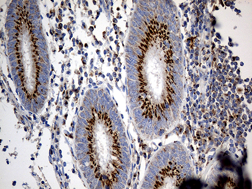 PTPN22 / PEP Antibody - Immunohistochemical staining of paraffin-embedded Human appendix tissue within the normal limits using anti-PTPN22 mouse monoclonal antibody. (Heat-induced epitope retrieval by 1mM EDTA in 10mM Tris buffer. (pH8.5) at 120°C for 3 min. (1:1000)