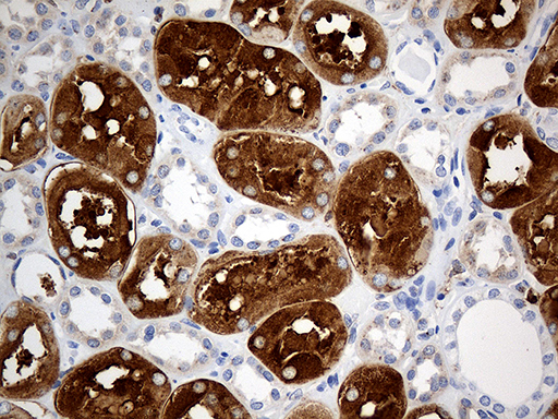 PTPN22 / PEP Antibody - Immunohistochemical staining of paraffin-embedded Human Kidney tissue within the normal limits using anti-PTPN22 mouse monoclonal antibody. (Heat-induced epitope retrieval by 1mM EDTA in 10mM Tris buffer. (pH8.5) at 120°C for 3 min. (1:1000)