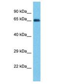 PTPN22 / PEP Antibody - PTPN22 / PEP antibody Western Blot of Thyroid Tumor. Antibody dilution: 1 ug/ml.  This image was taken for the unconjugated form of this product. Other forms have not been tested.