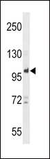 PTPN22 / PEP Antibody - PTPN22 Antibody western blot of NCI-H460 cell line lysates (35 ug/lane). The PTPN22 antibody detected the PTPN22 protein (arrow).