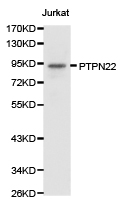 PTPN22 / PEP Antibody - Western blot of extracts of Jurkat cell lines, using PTPN22 antibody.