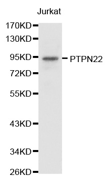 PTPN22 / PEP Antibody - Western blot analysis of extracts of Jurkat cell lines.