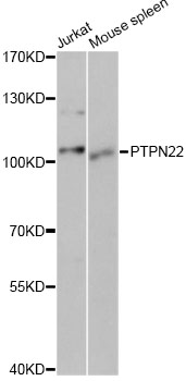 PTPN22 / PEP Antibody - Western blot analysis of extracts of various cell lines, using PTPN22 antibody at 1:1000 dilution. The secondary antibody used was an HRP Goat Anti-Rabbit IgG (H+L) at 1:10000 dilution. Lysates were loaded 25ug per lane and 3% nonfat dry milk in TBST was used for blocking. An ECL Kit was used for detection and the exposure time was 5s.