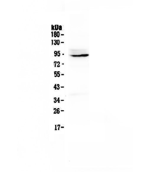 PTPN22 / PEP Antibody - Western blot - Anti-PTPN22/Lyp Picoband antibody