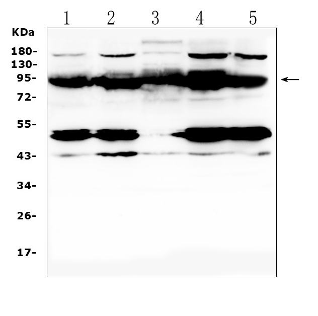 PTPN22 / PEP Antibody - Western blot analysis of PTPN22 using anti-PTPN22 antibody. Electrophoresis was performed on a 5-20% SDS-PAGE gel at 70V (Stacking gel) / 90V (Resolving gel) for 2-3 hours. The sample well of each lane was loaded with 50ug of sample under reducing conditions. Lane 1: human SW579 whole cell lysates, Lane 2: human HepG2 whole cell lysates, Lane 3: human placenta tissue lysates, Lane 4: human Hela whole cell lysates, Lane 5: human SW620 whole cell lysates. After Electrophoresis, proteins were transferred to a Nitrocellulose membrane at 150mA for 50-90 minutes. Blocked the membrane with 5% Non-fat Milk/ TBS for 1.5 hour at RT. The membrane was incubated with rabbit anti-PTPN22 antigen affinity purified polyclonal antibody at 0.5 µg/mL overnight at 4°C, then washed with TBS-0.1% Tween 3 times with 5 minutes each and probed with a goat anti-rabbit IgG-HRP secondary antibody at a dilution of 1:10000 for 1.5 hour at RT. The signal is developed using an Enhanced Chemiluminescent detection (ECL) kit with Tanon 5200 system. A specific band was detected for PTPN22 at approximately 92KD. The expected band size for PTPN22 is at 92KD.