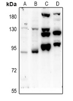 PTPN22 / PEP Antibody - Western blot analysis of PTPN22 expression in Jurkat (A), K562 (B), C6 (C), BV2 (D) whole cell lysates.