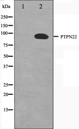 PTPN22 / PEP Antibody - Western blot analysis on HeLa cell lysates using PTPN22 antibody. The lane on the left is treated with the antigen-specific peptide.