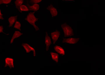 PTPN22 / PEP Antibody - Staining HeLa cells by IF/ICC. The samples were fixed with PFA and permeabilized in 0.1% Triton X-100, then blocked in 10% serum for 45 min at 25°C. The primary antibody was diluted at 1:200 and incubated with the sample for 1 hour at 37°C. An Alexa Fluor 594 conjugated goat anti-rabbit IgG (H+L) Ab, diluted at 1/600, was used as the secondary antibody.