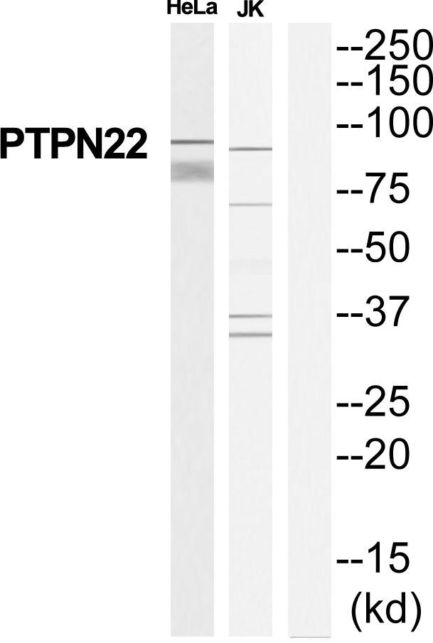 PTPN22 / PEP Antibody - Western blot analysis of extracts from HeLa/Jurkat cells, using PTPN22 antibody.