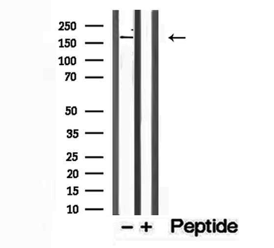 PTPN23 / HDPTP Antibody - Western blot analysis of extracts of HeLa cells using PTPN23 antibody.