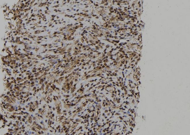 PTPN23 / HDPTP Antibody - 1:100 staining human spleen tissue by IHC-P. The sample was formaldehyde fixed and a heat mediated antigen retrieval step in citrate buffer was performed. The sample was then blocked and incubated with the antibody for 1.5 hours at 22°C. An HRP conjugated goat anti-rabbit antibody was used as the secondary.