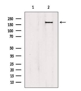 PTPN23 / HDPTP Antibody - Western blot analysis of extracts of HepG2 cells using PTPN23 antibody. Lane 1 was treated with the blocking peptide.