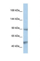 PTPN3 Antibody - PTPN3 antibody Western blot of PANC1 Cell lysate. Antibody concentration 1 ug/ml.  This image was taken for the unconjugated form of this product. Other forms have not been tested.